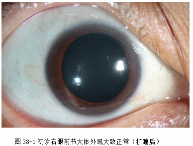 ZY016_202_2.gif
